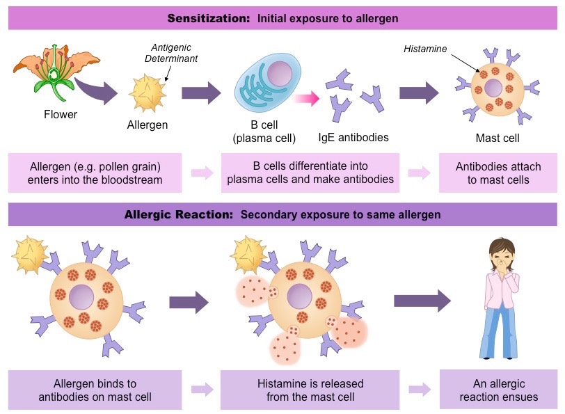 allergic reaction