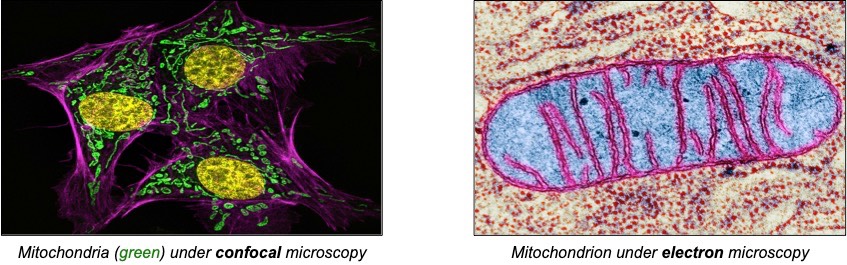 mitochondrion micrograph